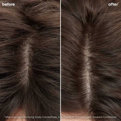 Matrix Biolage ScalpSync Dandruff Control korpásodás elleni sampon, 250 ml