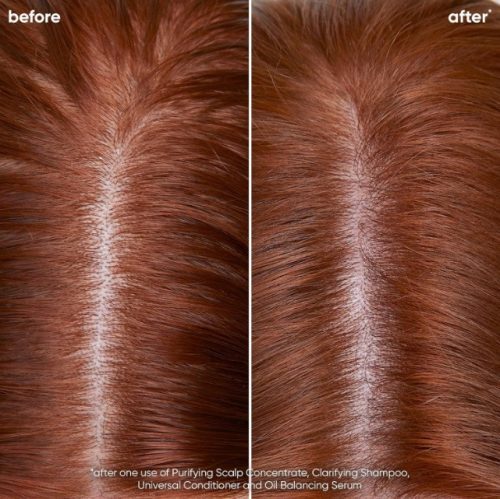 Matrix Biolage ScalpSync Clarifying mélytisztító sampon, 1 l