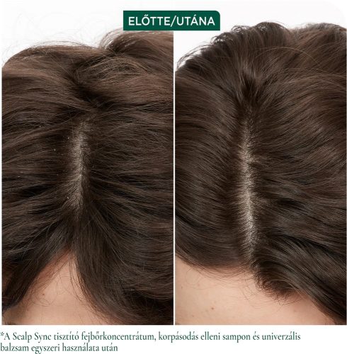 Matrix Biolage ScalpSync Dandruff Control korpásodás elleni sampon, 400 ml