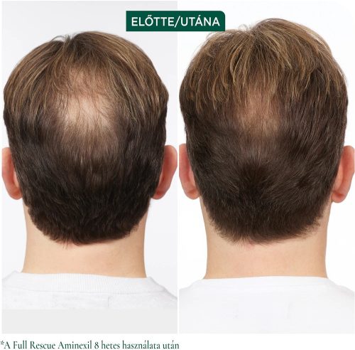 Matrix Biolage Full Rescue Aminexil hajhullás elleni regeneráló ampulla, 10x6 ml