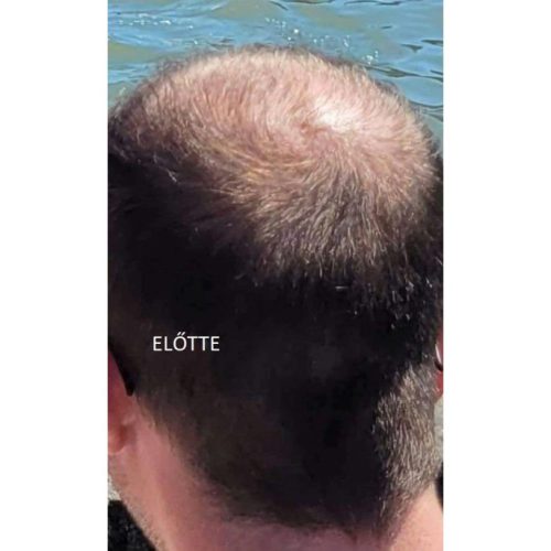 Fito.C Koffein hajhullás elleni revitalizáló tonik férfiaknak, 200 ml