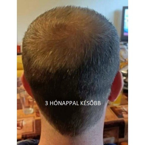 Fito.C Koffein hajhullás elleni revitalizáló tonik férfiaknak, 200 ml