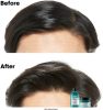 Loreal Scalp Advanced sampon zsíros hajra, utántöltő, 500 ml