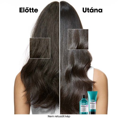 Loreal Scalp Advanced nyugtató sampon érzékeny fejbőrre, utántöltő 500 ml