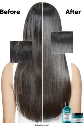 Loreal Scalp Advanced 2in1 mélytisztító sampon és pakolás zsíros hajra, 250 ml
