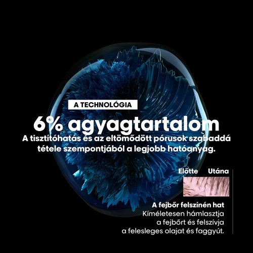 Loreal Scalp Advanced sampon zsíros hajra, 1500 ml