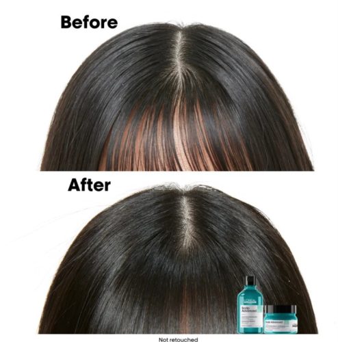 Loreal Scalp Advanced sampon zsíros hajra, 300 ml