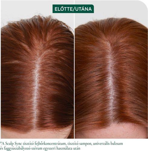 Matrix Biolage ScalpSync Clarifying mélytisztító sampon, 400 ml